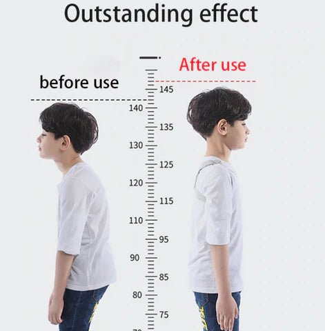 Smart Posture Perfect: Your Intelligent Posture Corrector - Homie Mart